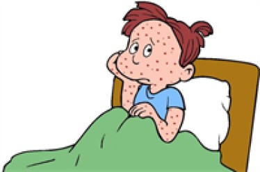 Những sai lầm hay gặp khi trẻ bị thủy đậu