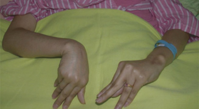 Hạ canxi máu