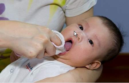 Chăm sóc khi trẻ mọc răng sữa